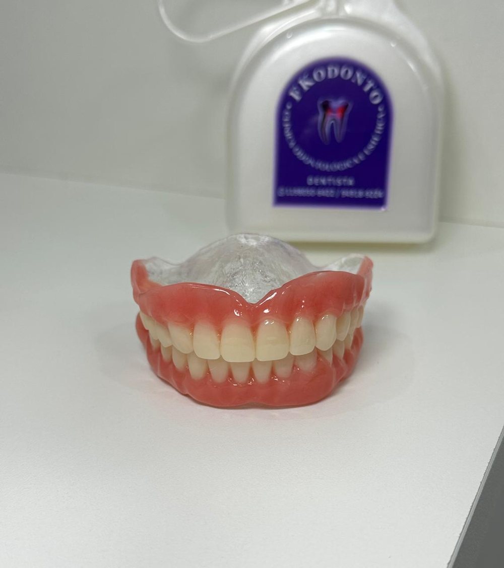 Prótese dentária finalizada pela equipe FKODONTO